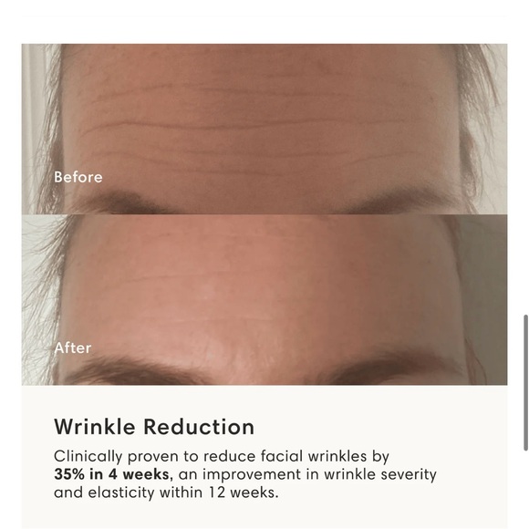 Boost LED Face Mask - Picture 12 of 12